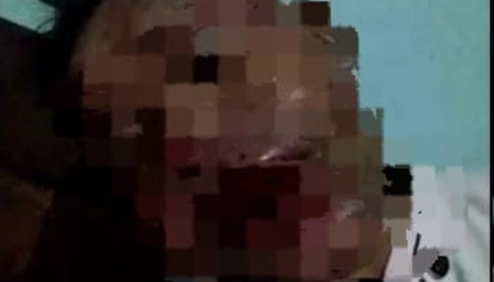 Kepala KUA Botang Loman Dianiaya Hingga Muntah Darah, Begini Kronologisnya